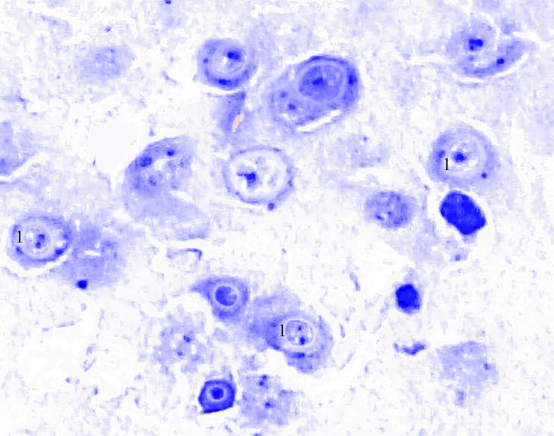 ris3