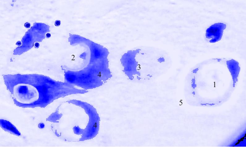 ris3