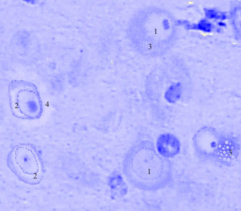 ris3