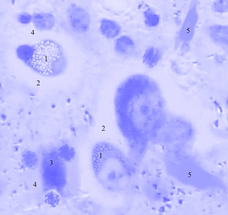 ris3