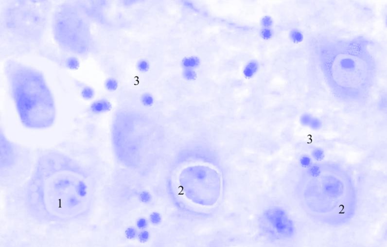 ris3