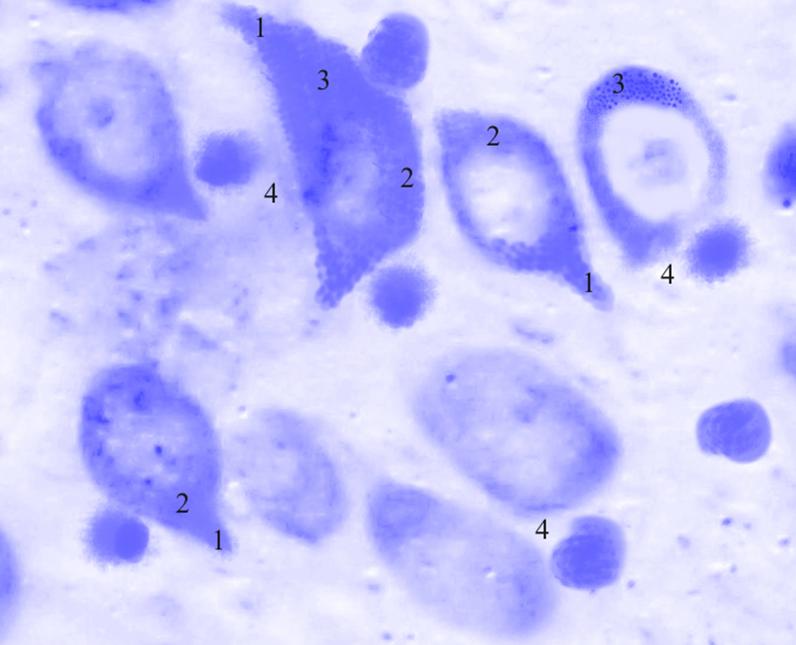 ris3