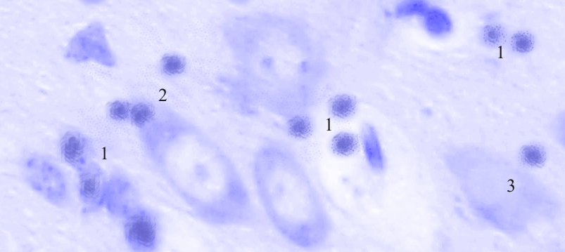 ris3