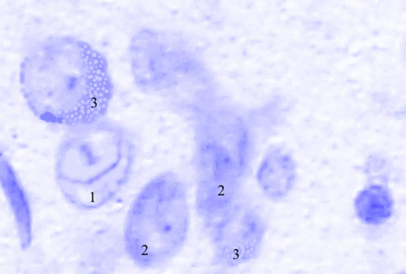 ris3