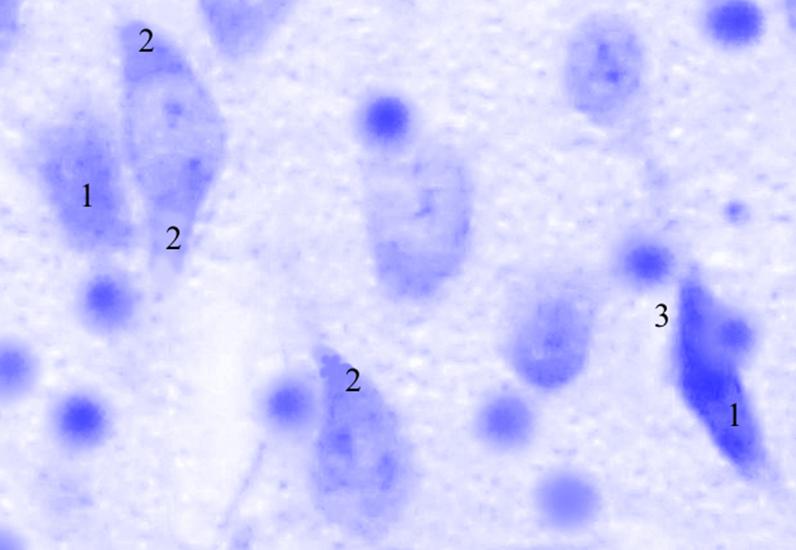 ris3