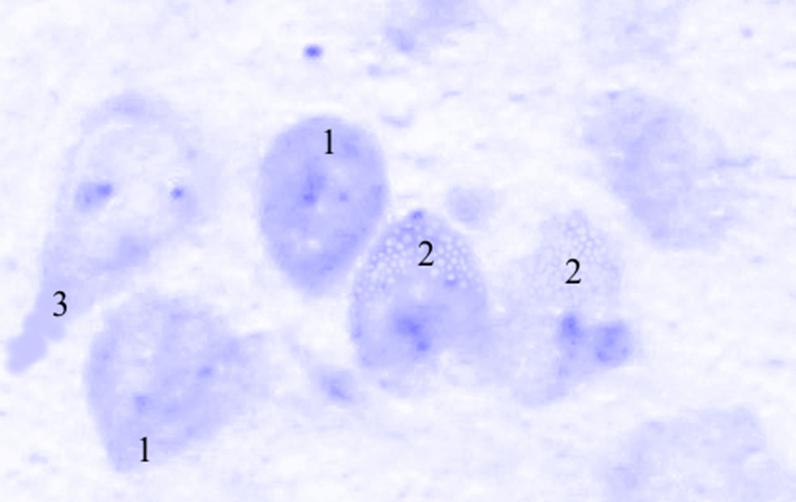 ris3