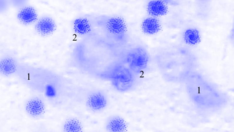 ris3