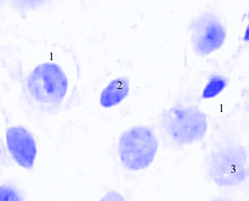 ris3