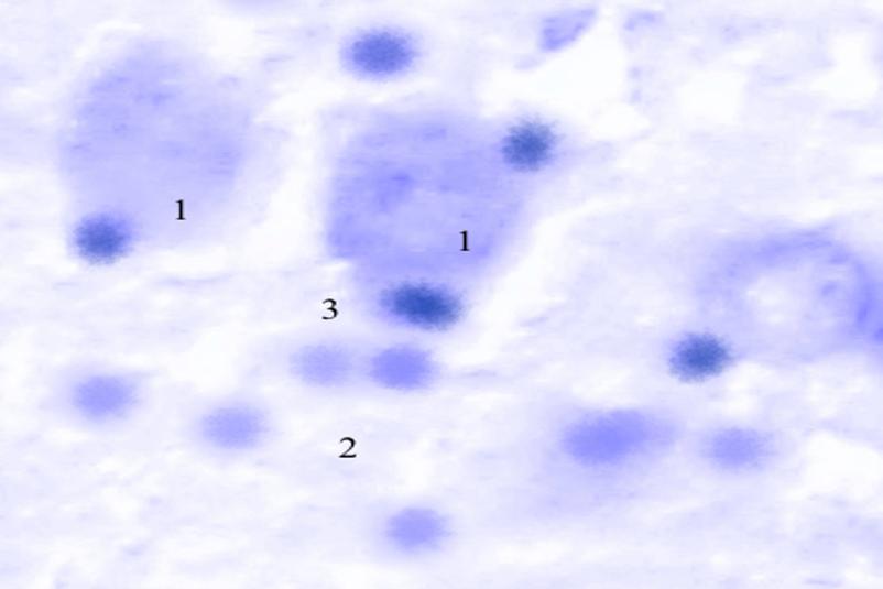 ris3