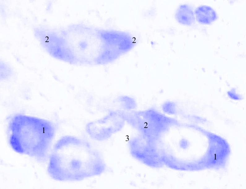 ris3