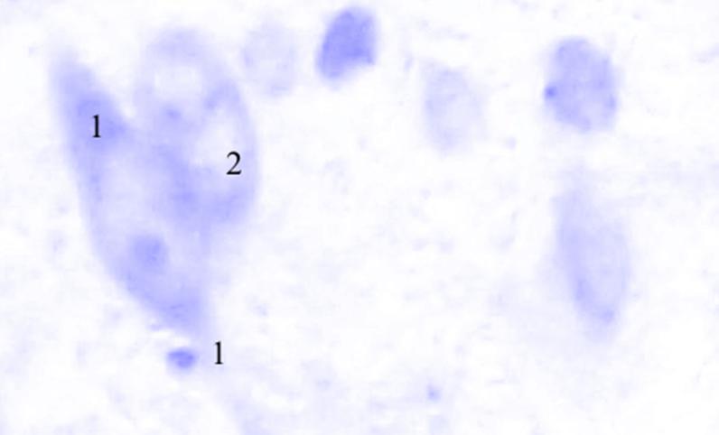 ris3