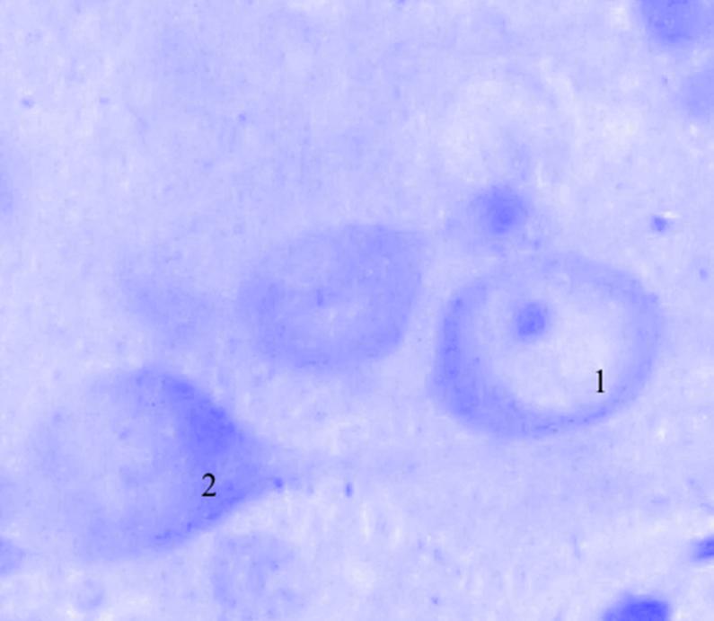 ris3