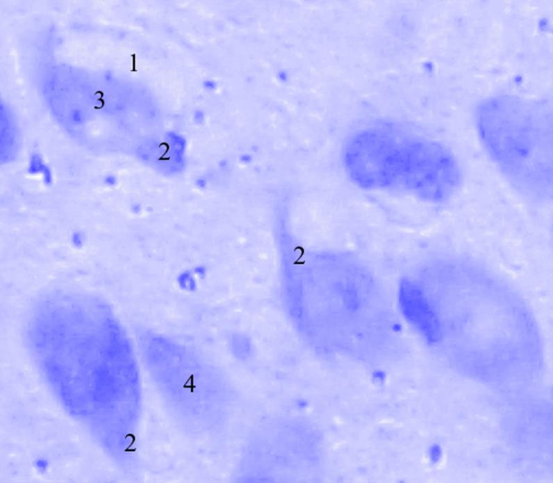 ris3