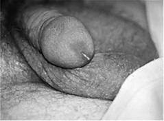 b00000930.jpg